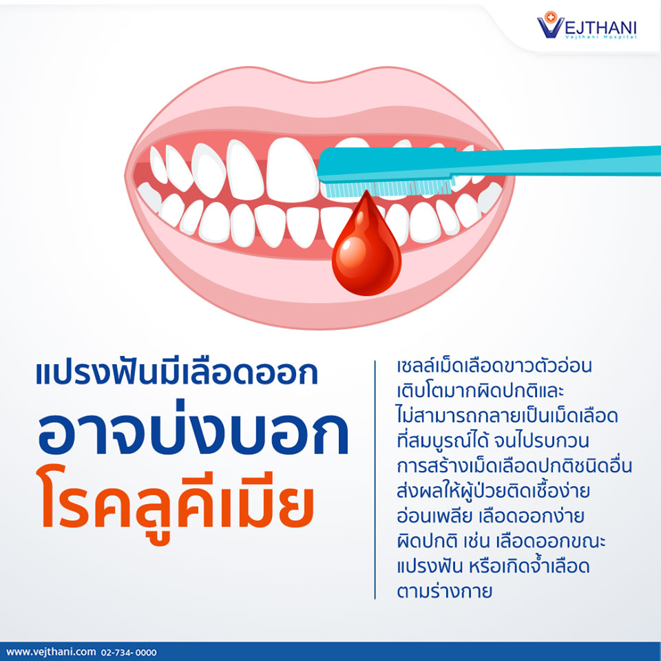 แปรงฟันมีเลือดออกอาจบ่งบอกโรคลูคีเมีย