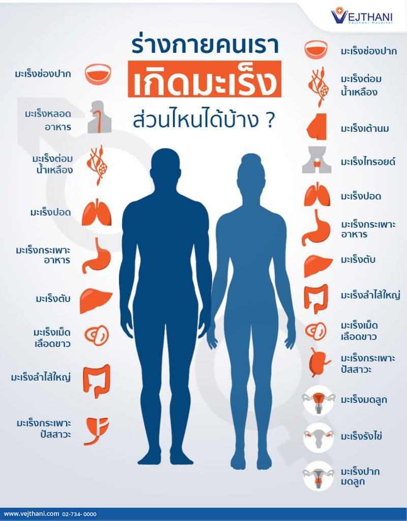 ร่างกายคนเรา สามารถเกิดมะเร็งส่วนไหนได้บ้าง ?