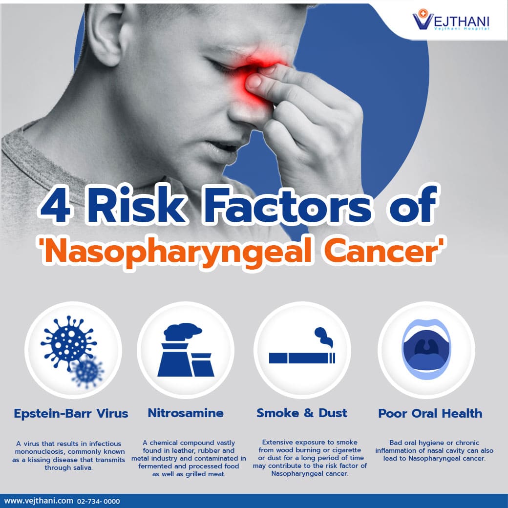 4 Risk Factors of Nasopharyngeal cancer