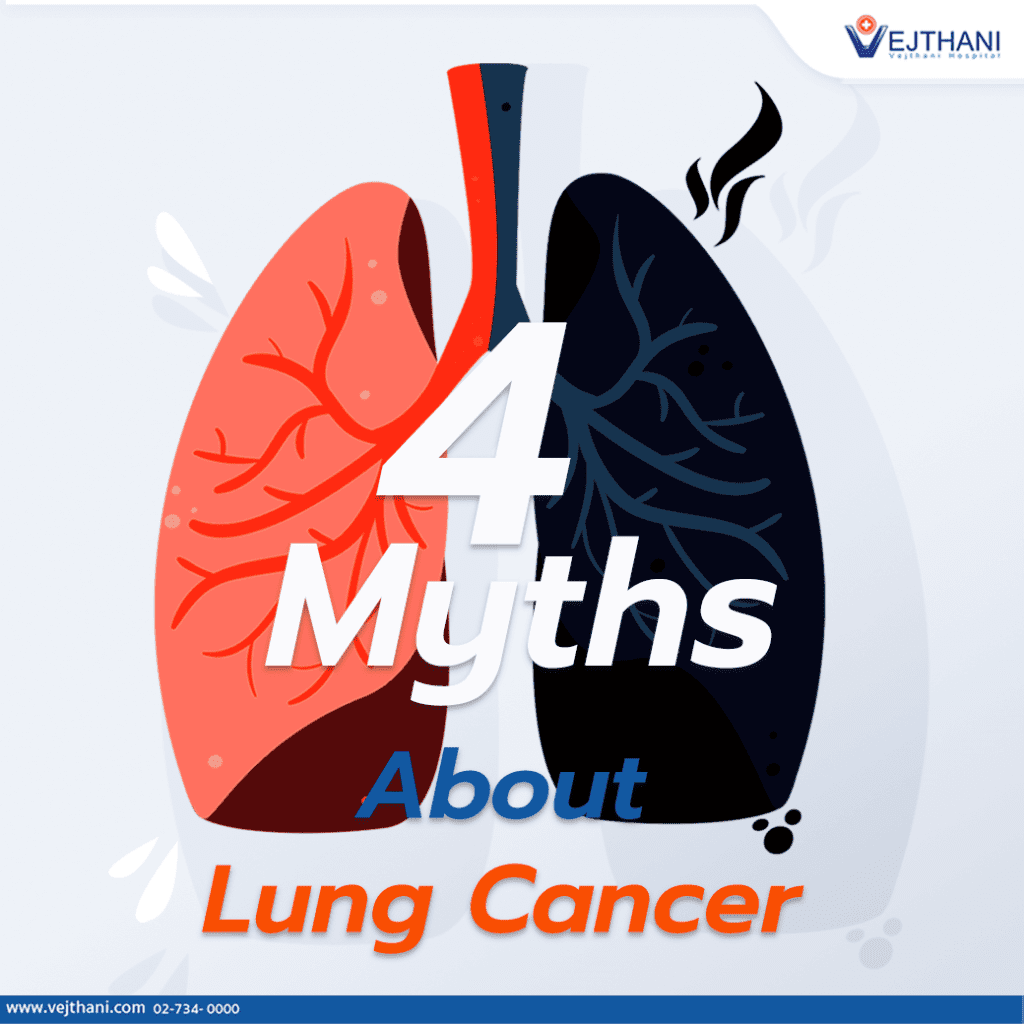 4 Myths about Lung Cancer