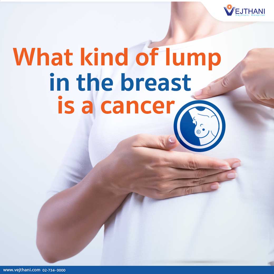 What kind of lump in the breast is a cancer?