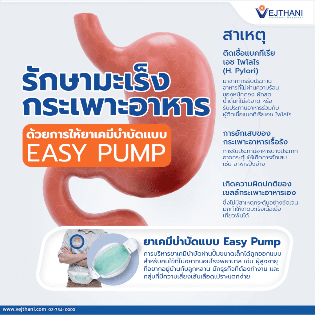 รักษามะเร็งกระเพาะอาหาร ด้วยการให้ยาเคมีบำบัดแบบ Easy Pump