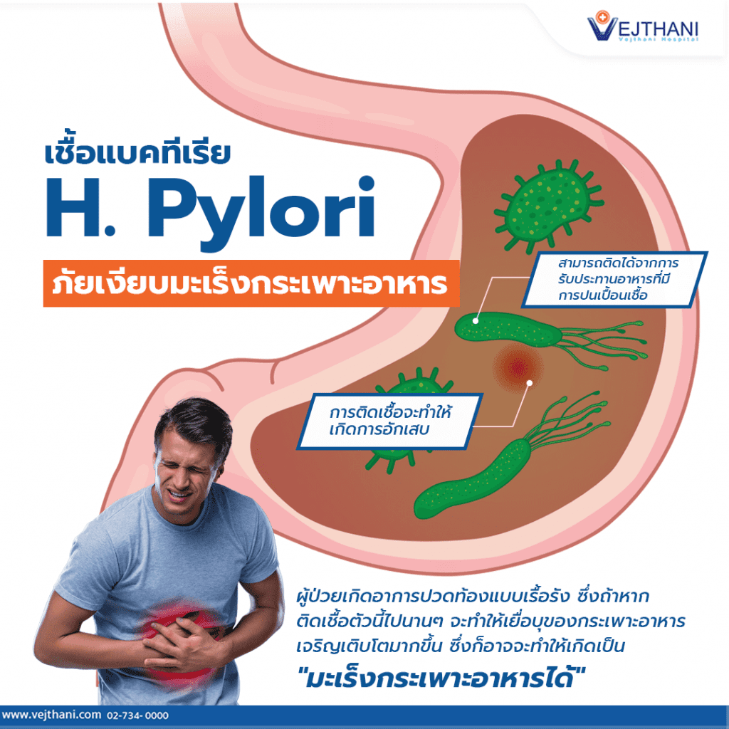 เชื้อแบคทีเรีย H.Pylori ภัยเงียบมะเร็งกระเพาะอาหาร