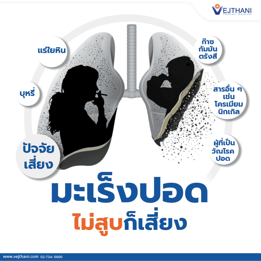 มะเร็งปอดไม่สูบก็เสี่ยง