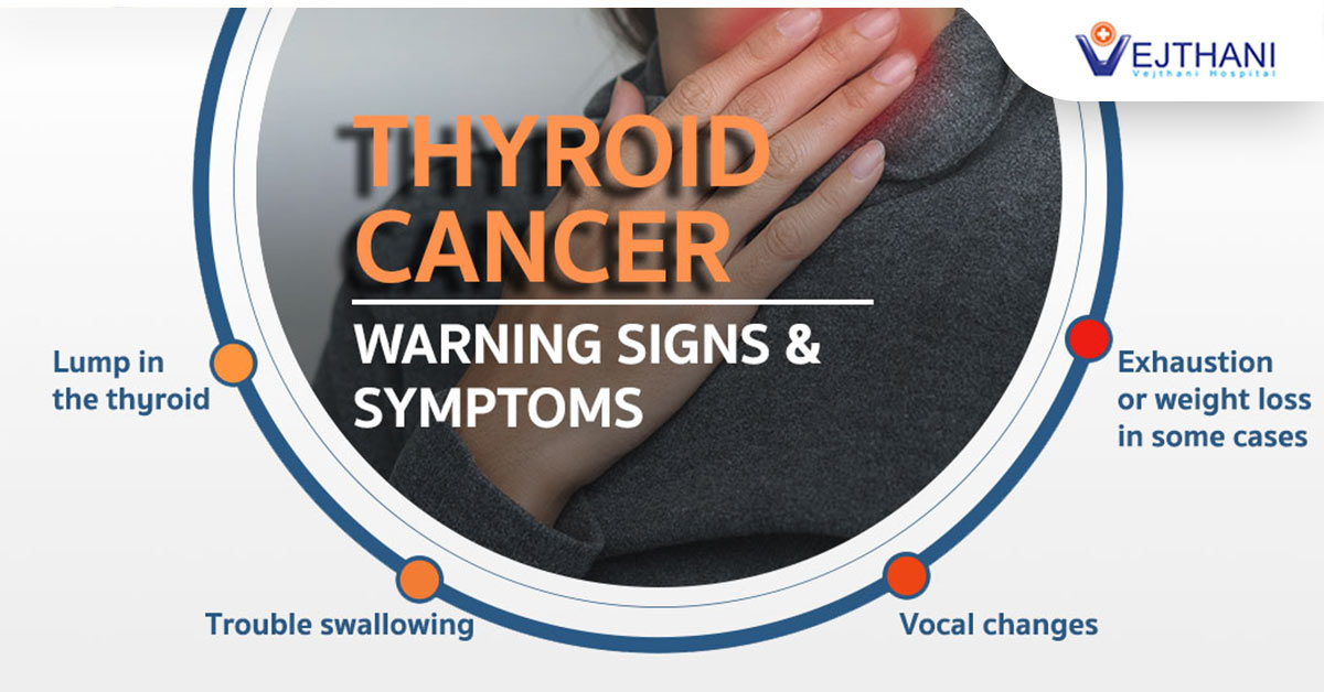 Thyroid Cancer is Treatable! Life Cancer Center