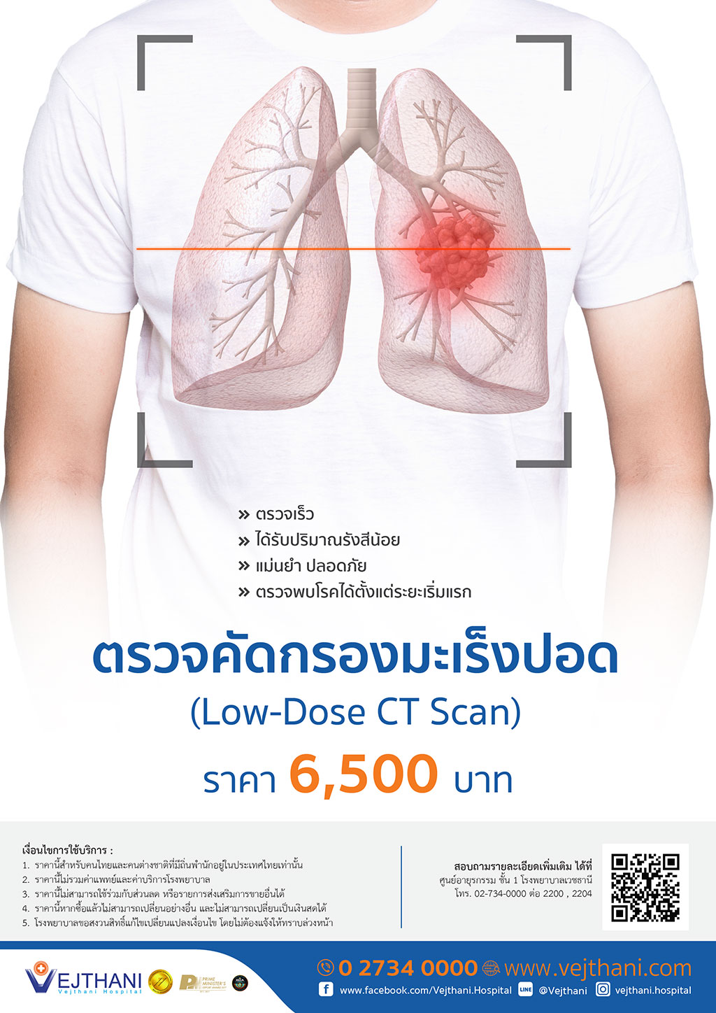 ตรวจคัดกรองมะเร็งปอด (Low-Dose CT Scan)