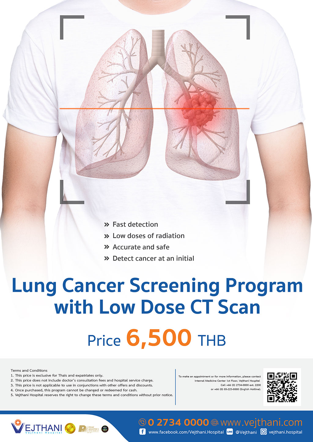 Lung Cancer Screening Program with Low Dose CT Scan