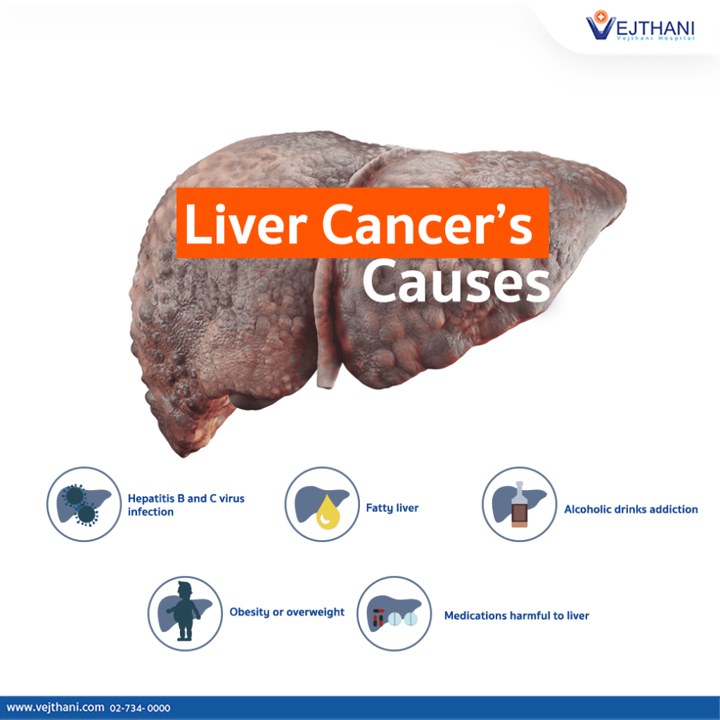 Liver Cancer’s Causes