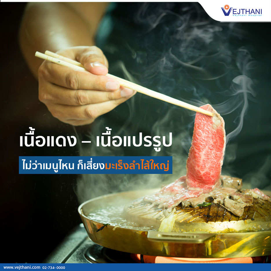 “เนื้อแดง – เนื้อแปรรูป” ไม่ว่าเมนูไหน ก็เสี่ยงมะเร็งลำไส้ใหญ่