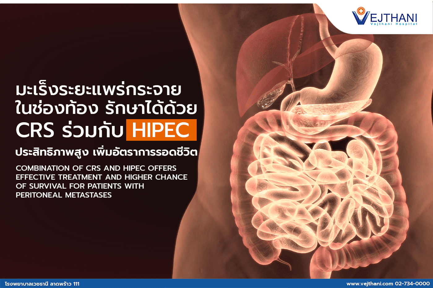 มะเร็งระยะแพร่กระจายในช่องท้อง รักษาได้ด้วย CRS ร่วมกับ HIPEC ประสิทธิภาพสูง เพิ่มอัตราการรอดชีวิต