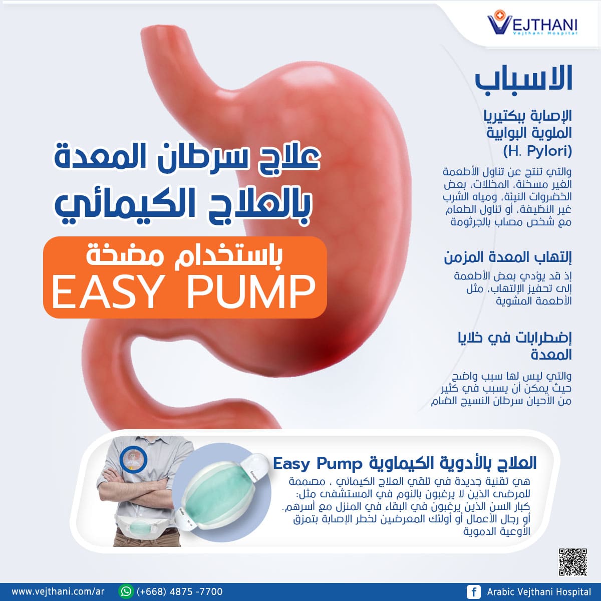 علاج سرطان المعدة بالعلاج الكیمائي باستخدام مضخة Pump E